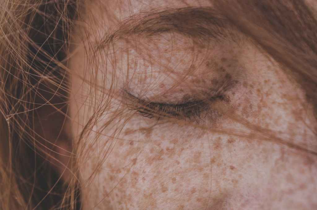 5 Secrets the Beauty Industry Doesn’t Want You to Know About Dark Spots and Hyperpigmentation!